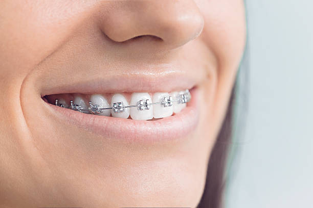 Best Tooth Extraction  in Vinton, LA